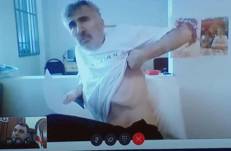 Saakaşvilinin xəstəxanadan görüntüləri... – Video