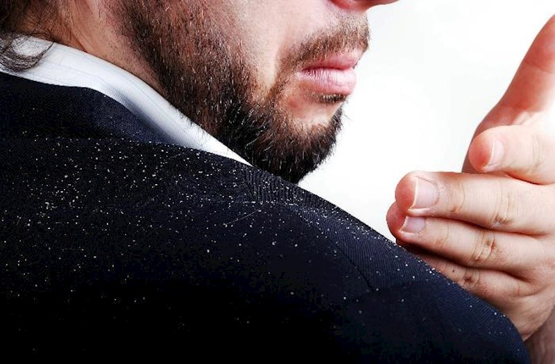 Qış gəlməmiş niyə kəpək artır?