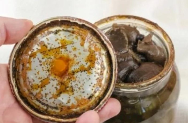 Botulizm nədir və nə üçün təhlükəlidir?