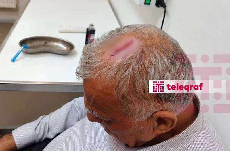 Şəkidə icra nümayəndəsi bələdiyyə sədrinin başına butulka çırpıb – KİV