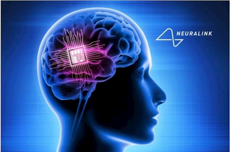 “Neuralink” insan beyni üçün riyazi prosessor hazırlayacaq