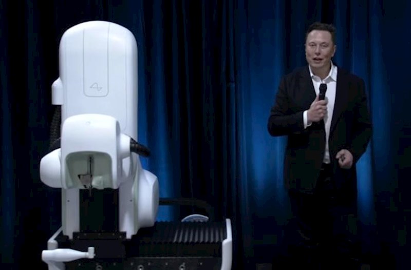 “Neuralink” beyin əməliyyatları üçün robot cərrah hazırlayır